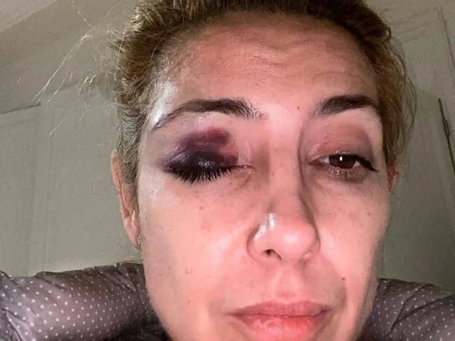 Con una pericia psiquiátrica a Fabiola Yañez en la justicia porteña, Alberto Fernández busca frenar la causa por violencia de género