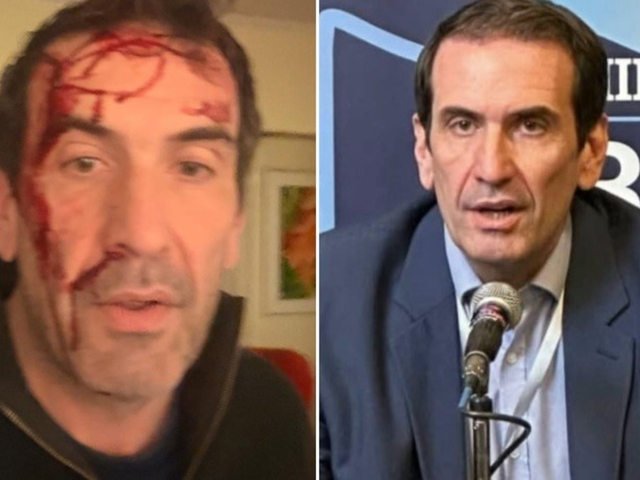 Asaltaron y golpearon a Pablo Cervi, candidato libertario en Neuquén, a horas de las elecciones