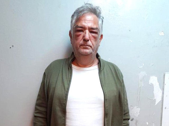 ANDIS: los cuadernos de Calvete revelaron otro circuito de corrupción con la compra de insumos de alto costo para los discapacitados